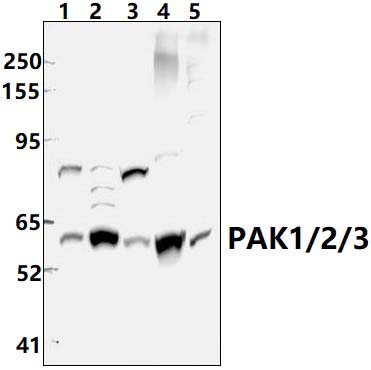 PAK1/2/3 (E417)