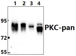 PKC~pan (T495)