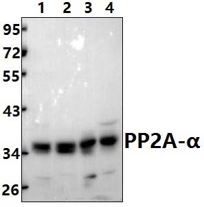 PP2A~α (T301)