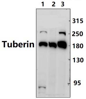 Tuberin (L1456)