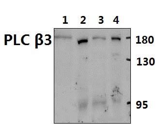 PLC β3 (D1099)