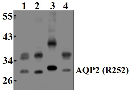 AQP2 (R252)