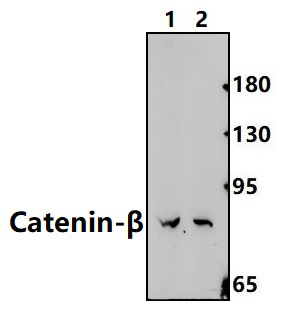 Catenin~β (G650)