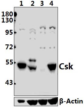 Csk (L558)