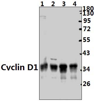 Cyclin D1 (L283)