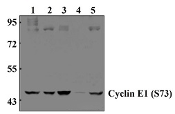 Cyclin E1 (S73)