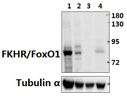 FKHR/FoxO1 (T323)