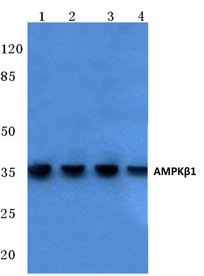 AMPKβ1 (V175)