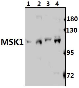 MSK1 (Q577)