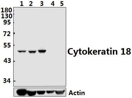 Cytokeratin 18 (S48)