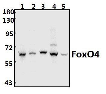 FoxO4 (K447)