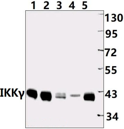 IKKγ (H81)