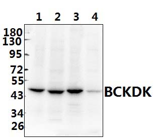 BCKDK (E41)
