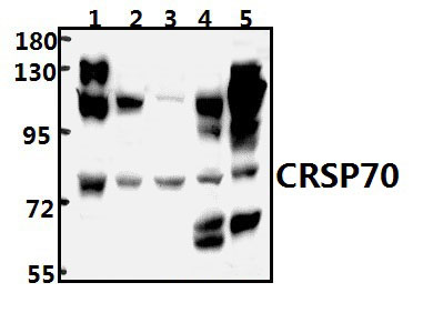 CRSP70 (S7)