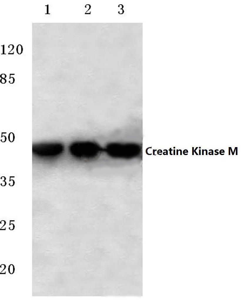 Creatine Kinase M (Y14)