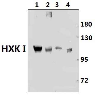 HXK I (F67)