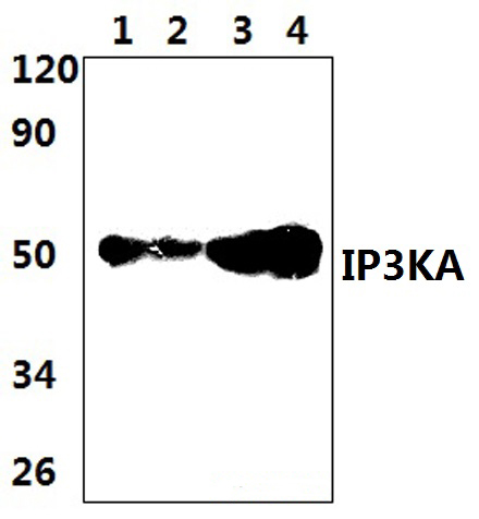 IP3KA (H431)