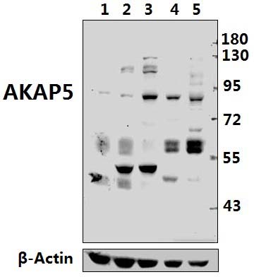 AKAP5 (E7)