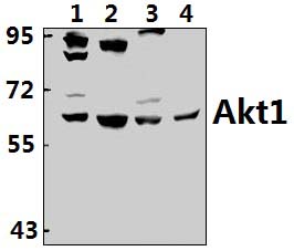 AKT1 (E40)