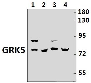 GRK5 (Q382)