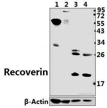 Recoverin (D143)