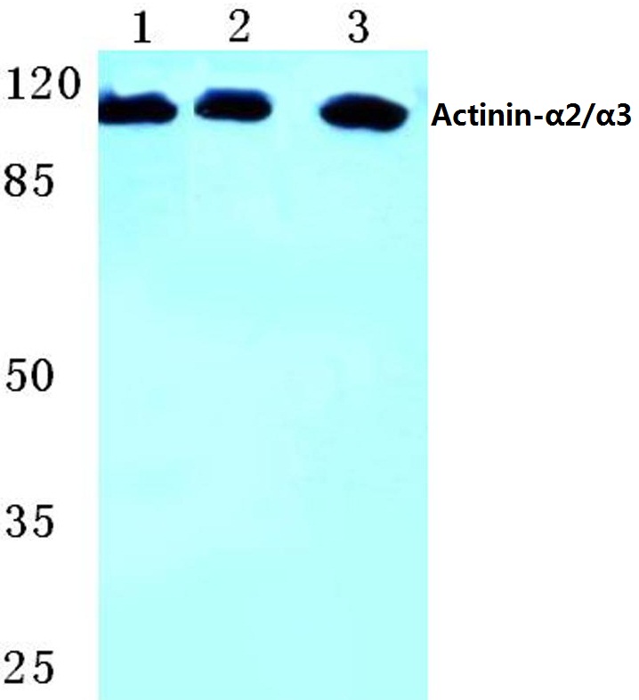 Actinin~α2/3 (Q58)