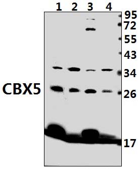 CBX5 (K69)