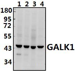 GALK1 (E15)