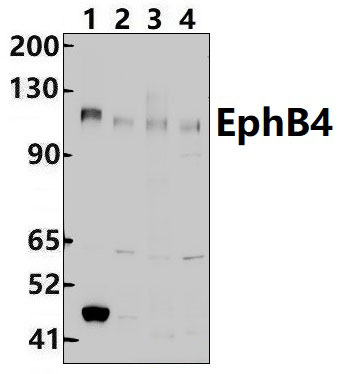 EphB4 (E601)