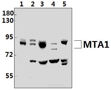 MTA1 (K182)