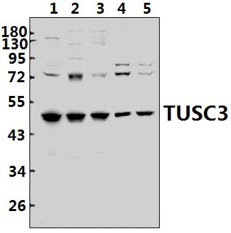 TUSC3 (H153)