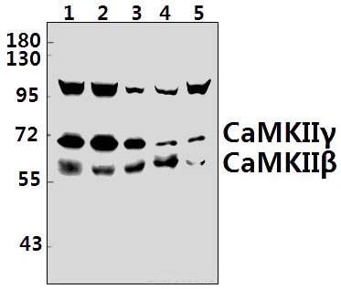 CaMKIIβ/γ (R631)