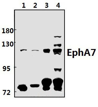 EphA7 (E477)