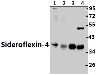 Sideroflexin~4 (G12)