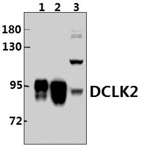 DCLK2 (E8)