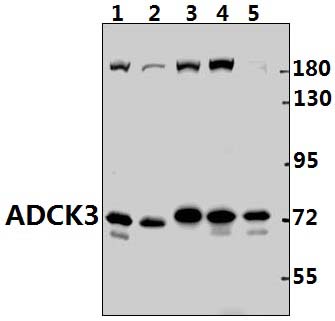 ADCK3 (N323)