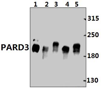 PARD3 (F1161)