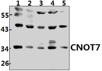 CNOT7 (N19)