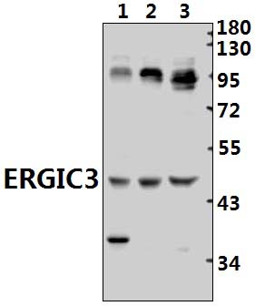 ERGIC3 (V332)