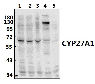 CYP27A1 (E131)