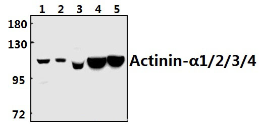 Actinin~α1/2/3/4 (W48)