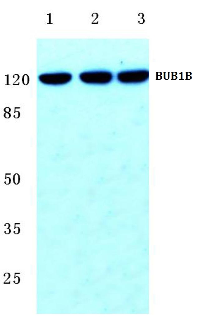 BUB1B (T368)