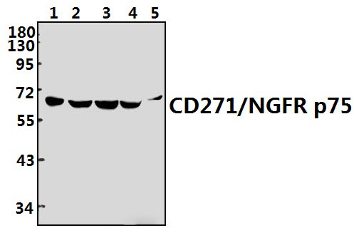 NGFR p75 (P150)
