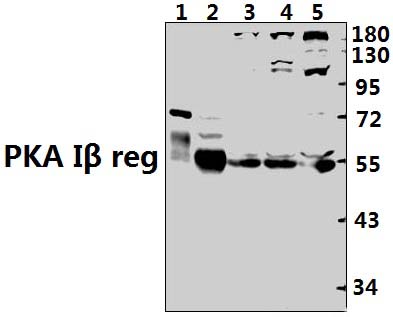 PKA Iβ reg (F138)