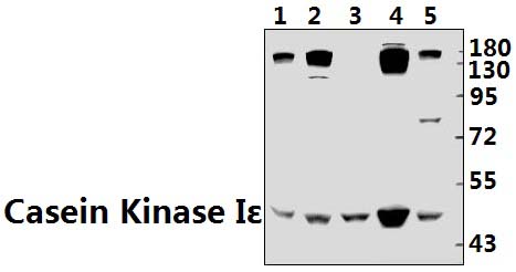 Casein Kinase Iε (P301)