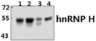 hnRNP H (R192)