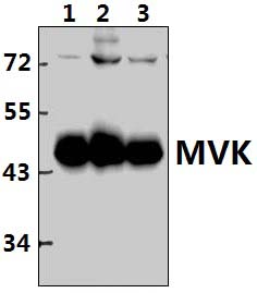 MVK (N175)