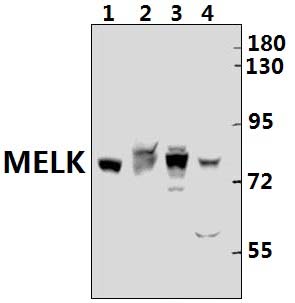MELK (N449)