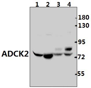 ADCK2 (Y256)