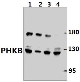 PHKB (E689)